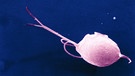 Ein Trichomonas vaginalis Bakterium durch ein Elektronenmikroskop gesehen. | Bild: picture-alliance/dpa