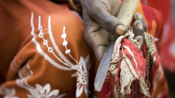 Messer für die weibliche Beschneidung in Äthiopien | Bild: dpa picture alliance/UNICEF/HOLT