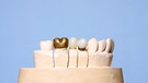 Symbolbild für Zahnersatz: Ein Goldener Zahn in einer Reihe von weißen (künstlichen) Zähnen. | Bild: colourbox.com