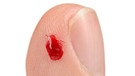 Finger mit Blutstropfen | Bild: colourbox.com