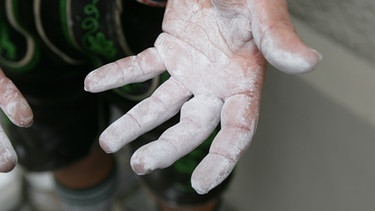 Ein Fingerhakler zeigt seine mit Magnesiapulver bedeckten Hände - der linke Mittelfinger ist vom Ziehen angeschwollen | Bild: Süddeutsche Zeitung Photo/Josef Wildgruber