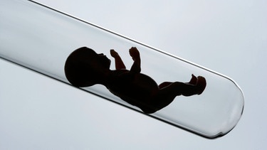 Shilouette eine Babypuppe im Reagenzglas | Bild: picture alliance / Ulrich Baumgarten | Ulrich Baumgarten