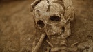 Ausgrabung eines Totenkopfs | Bild: BR 