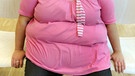 übergewichtige Frau | Bild: picture-alliance/dpa
