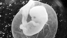 Embryo | Bild: picture-alliance/dpa
