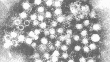 Hepatitis-Virus | Bild: picture-alliance/dpa