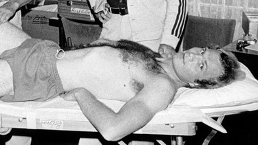 Uli Hoeneß verletzt auf der Massagebank 1976 | Bild: picture-alliance/dpa