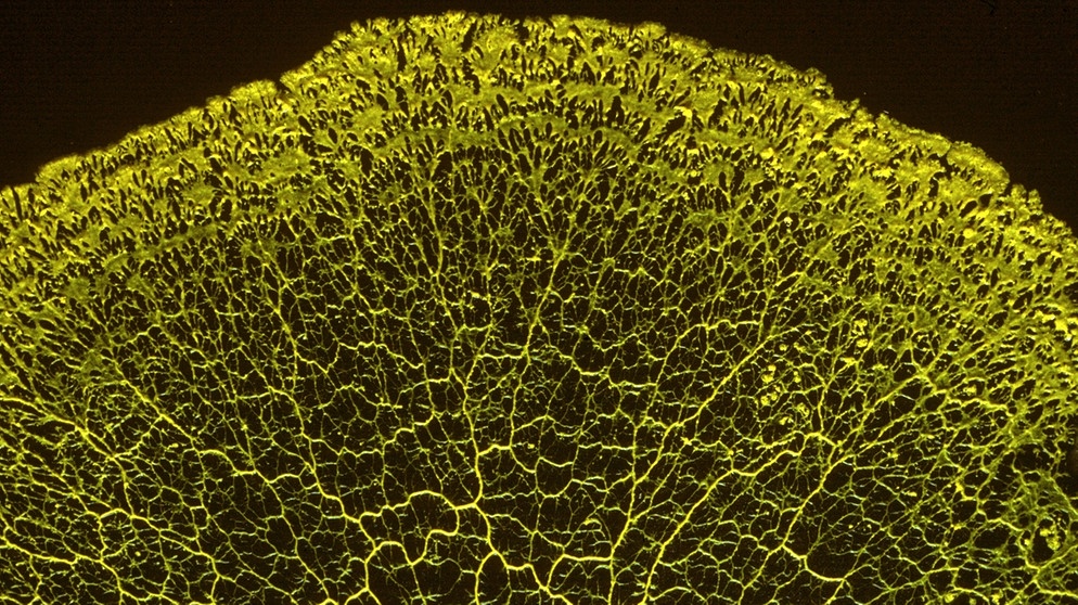 Einzeller des Jahres 2021: Schleimpilz Physarum polycephalum | Bild: Norbert Hülsmann