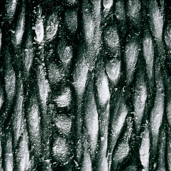 Rasterelektronenmikroskopische Aufnahme von Endothelzellen an einer großen Arterie. | Bild: picture alliance