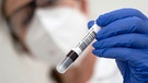 Corona Antikörper-Test: Eine Mitarbeiterin eines Labors hat ein Blutentahmeröhrchen mit Blut für einen Corona-Antikörper-Test in der Hand.  | Bild: dpa-Bildfunk/Marijan Murat
