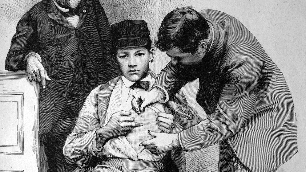 Tollwut-Schutzimpfung bei Professor Pasteur in Paris, Frankreich historische Illustration, circa 1886 | Bild: picture alliance / imageBROKER | BAO