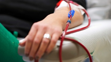 Unterarm einer Dialysepatientin | Bild: picture-alliance/dpa