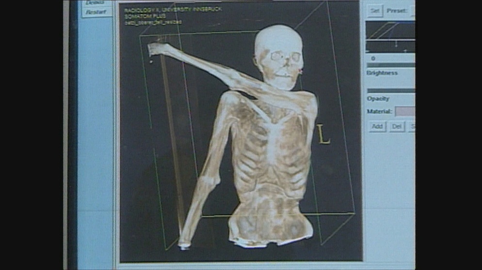 Grafik von Ötzi-Skelett | Bild: ORF