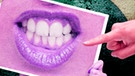 Bildcollage/Illustration: Von allen Seiten zeigen Finger auf ein Foto, das einen verzerrten Mund zeigt | Bild: colourbox.com; BR/Tanja Begovic